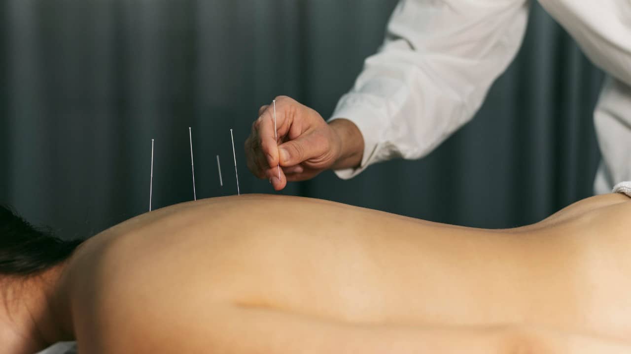 Can Acupuncture Help With Weight Loss - Weight Loss Clinic
